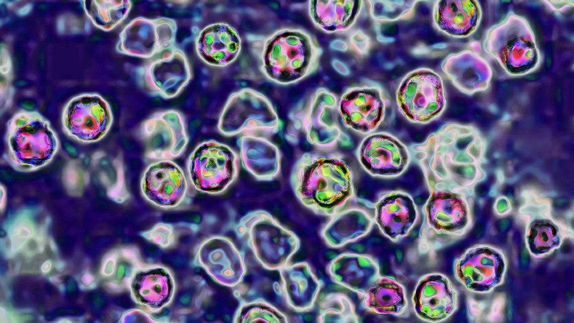 Measles outbreak in Pennsylvania claims 6th death