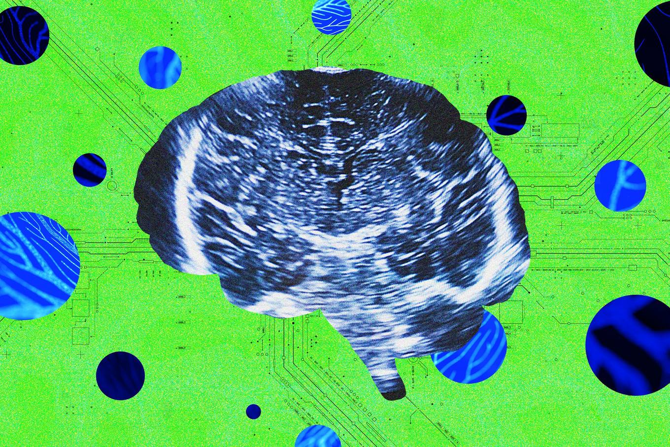 Bridge Neurotech Raises $13.5M for Ultrasound Interface